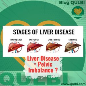 Read more about the article Hubungan Antara Pelvic Imbalances dan Perkembangan Penyakit atau Nyeri Liver