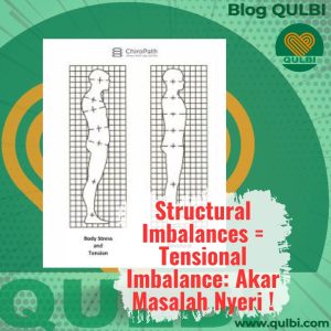 Read more about the article Structural Imbalances: Manifestasi Klinis dari Tensional Imbalance yang Sering Terabaikan