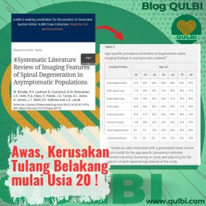 Read more about the article Terungkap! Kerusakan Tulang Belakang Bisa Dimulai di Usia 20 Tahun Meski Tanpa Keluhan Nyeri