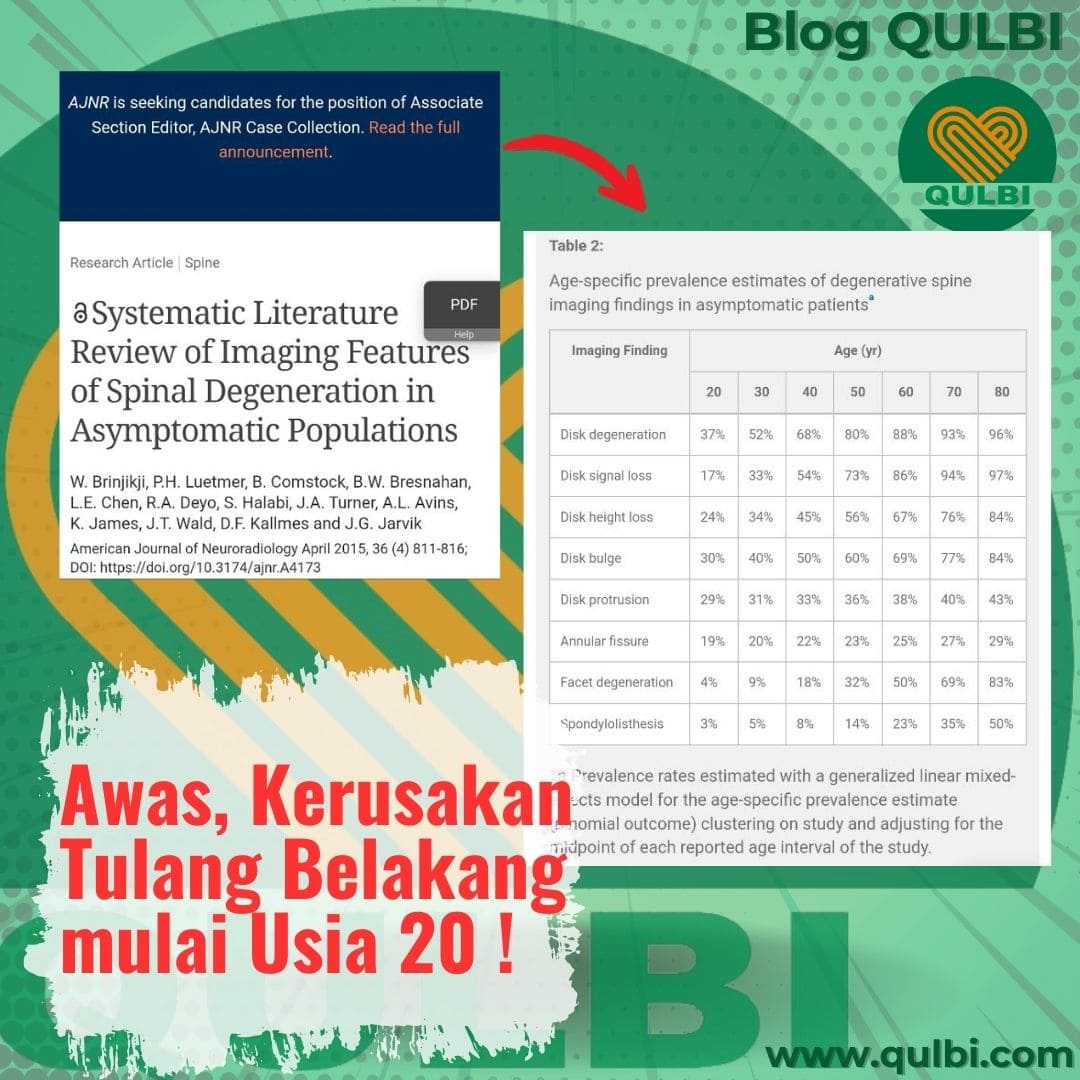 Read more about the article Terungkap! Kerusakan Tulang Belakang Bisa Dimulai di Usia 20 Tahun Meski Tanpa Keluhan Nyeri