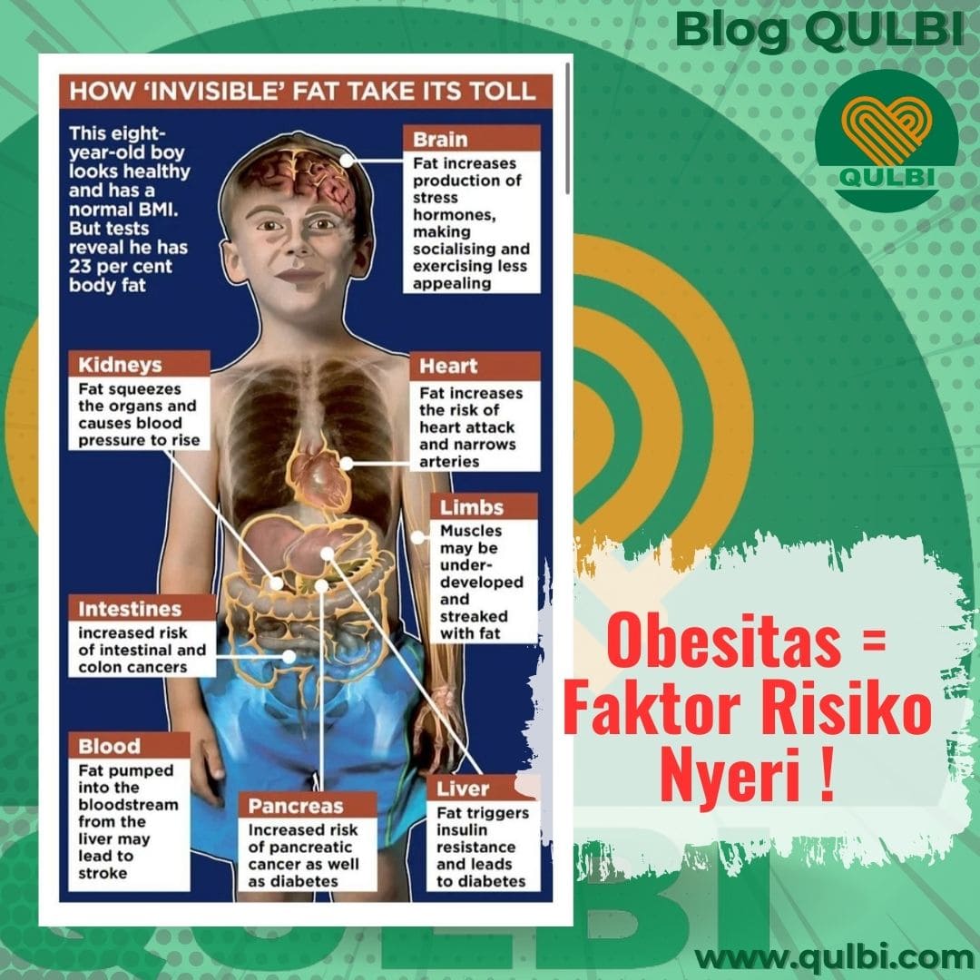 You are currently viewing Lemak Tersembunyi: Bahaya Obesitas -Faktor Risiko Nyeri- yang Tidak Disadari