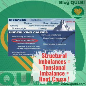 Read more about the article Functional Medicine: Nyeri atau Penyakit Itu Seperti Gunung Es – Dari Structural Imbalances ke Tensional Imbalance Sebagai Root Cause