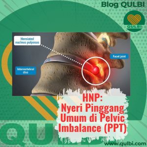 Read more about the article HNP: Si Biang Nyeri Pinggang yang Diam-Diam “Meledak” dan Cara Nge-Hack-nya!