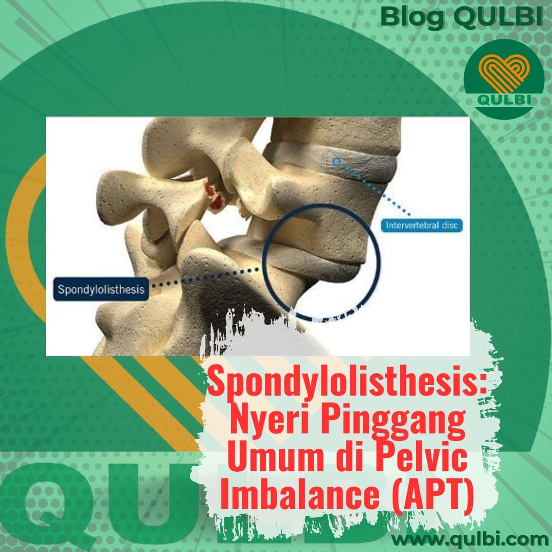 sakit pinggang akibat spondylolisthesis