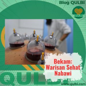 Read more about the article Bekam: Warisan Sehat Nabawi, Medis Modern, dan QULBI Habits