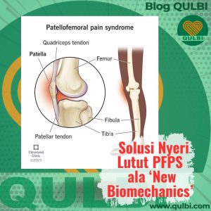 Read more about the article Patellofemoral Pain Syndrome (PFPS): Ketika Lutut Nyeri Jadi Alarm dari Masalah Lebih Dalam dan FASCIA Hack Solusinya