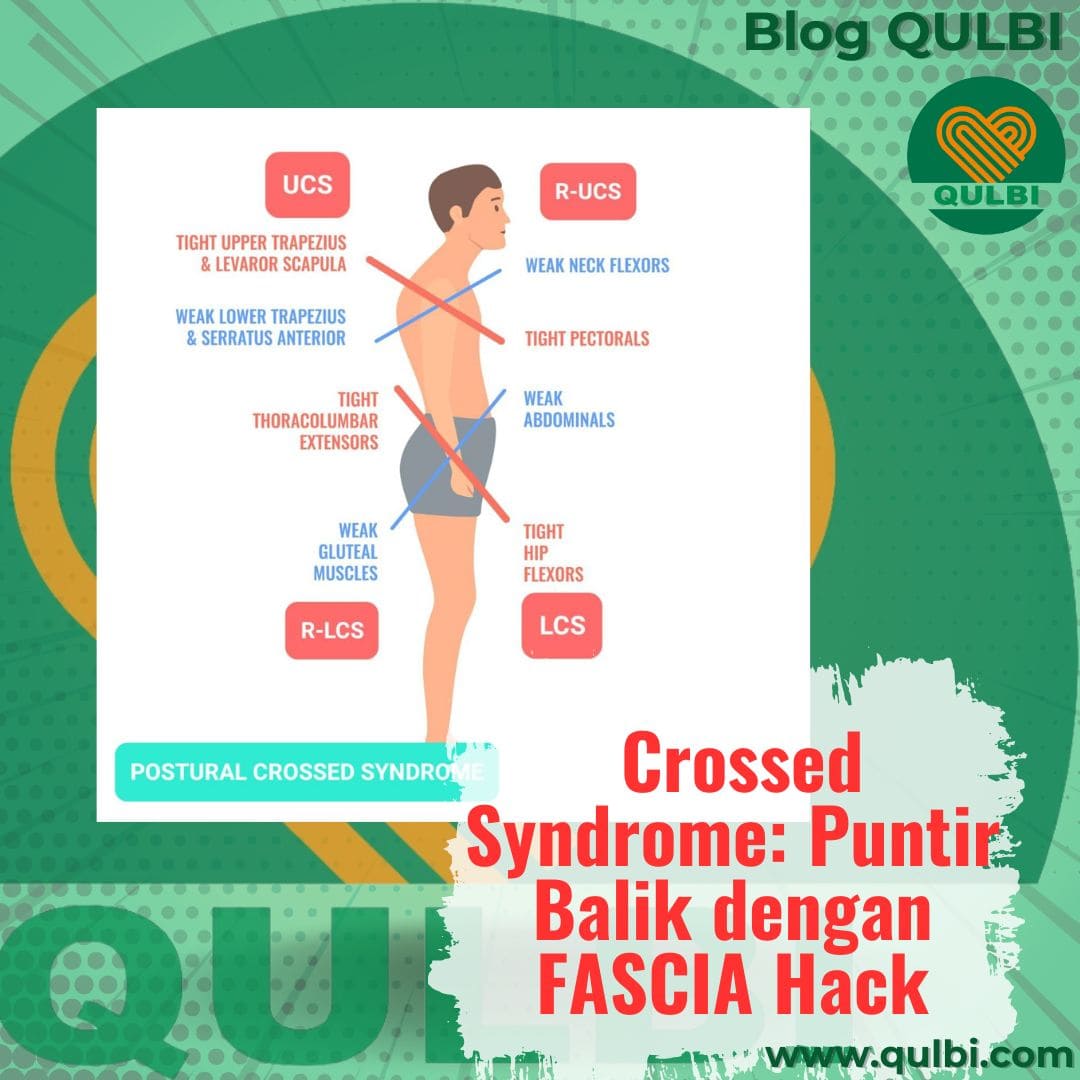 Read more about the article Crossed Syndrome: Ketika Otot Bekerja Silang, Bikin Postur Berantakan dan FASCIA Hack Solusinya!