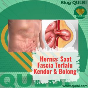 Read more about the article Hernia: Saat Fascia Terlalu Lemah & Bolong, Organ pun “Nyontek Keluar”