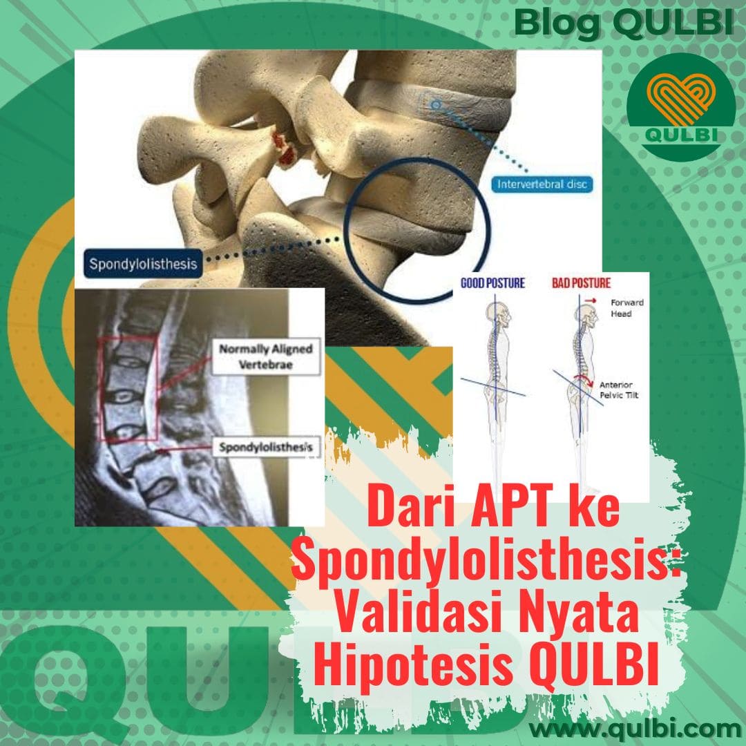 Pola APT Penyebab Saraf Kejepit Jenis Spondylolisthesis