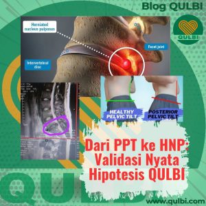 Read more about the article Pola PPT Penyebab Saraf Kejepit Jenis HNP: Validasi Nyata Hipotesis QULBI lewat MRI