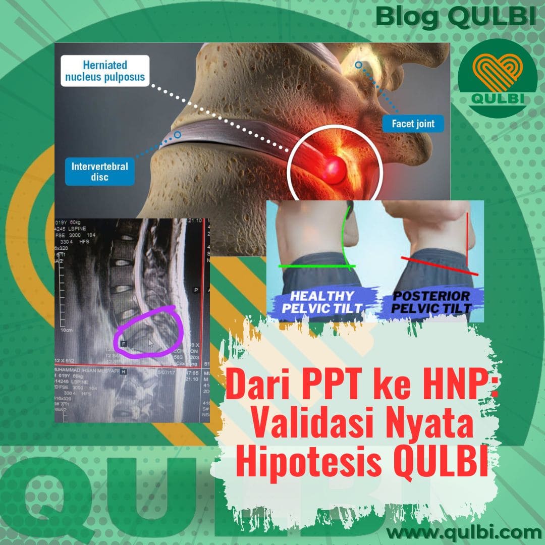 Pola PPT Penyebab Saraf Kejepit Jenis HNP: Validasi Nyata Hipotesis QULBI lewat MRI