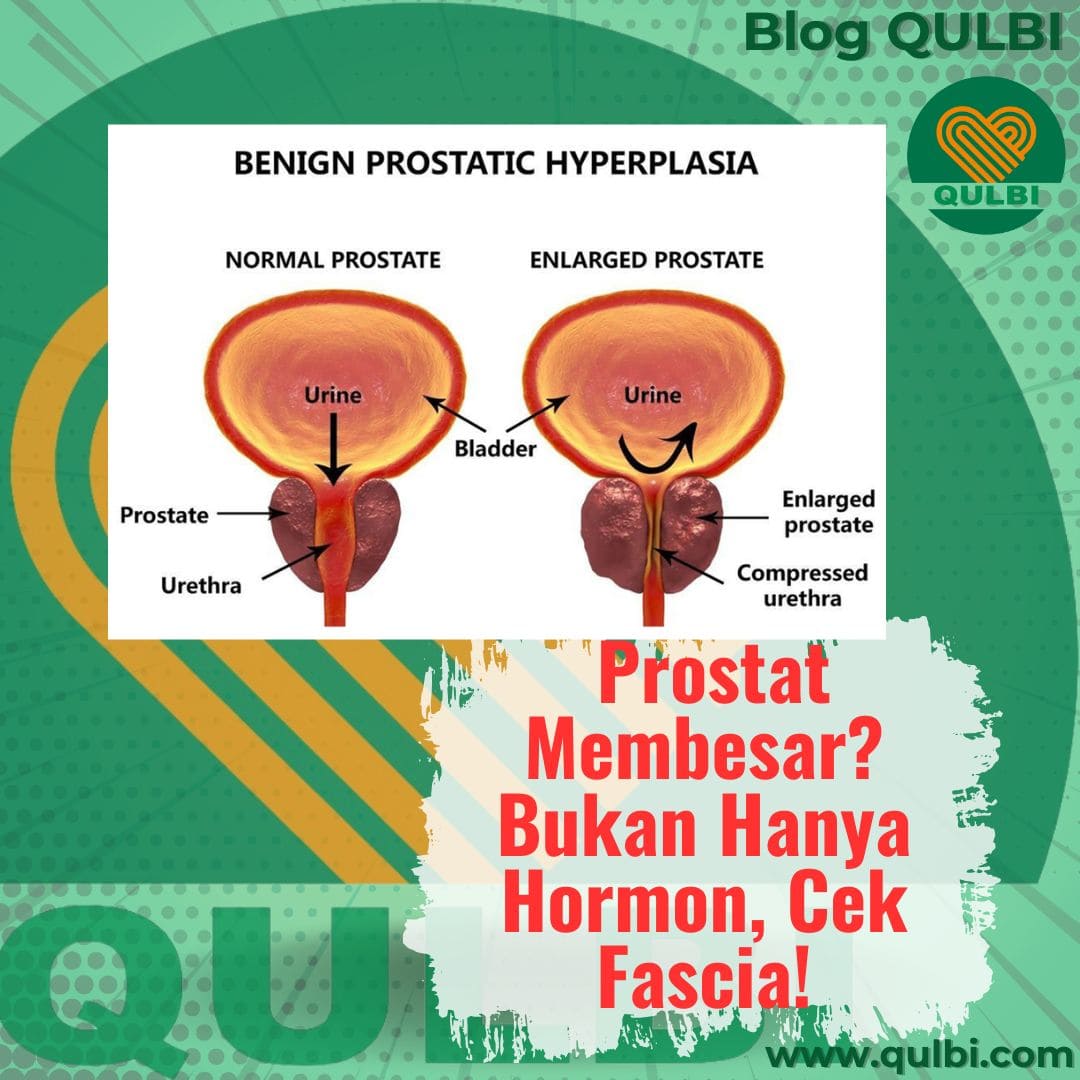 Obat Prostat Membesar