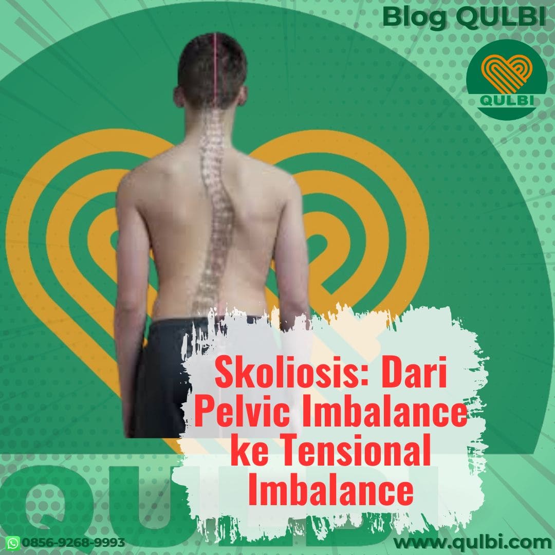 Read more about the article Skoliosis: Dari Pelvic Imbalance ke Tensional Imbalance dan Kacamata Biotensegrity ala QULBI